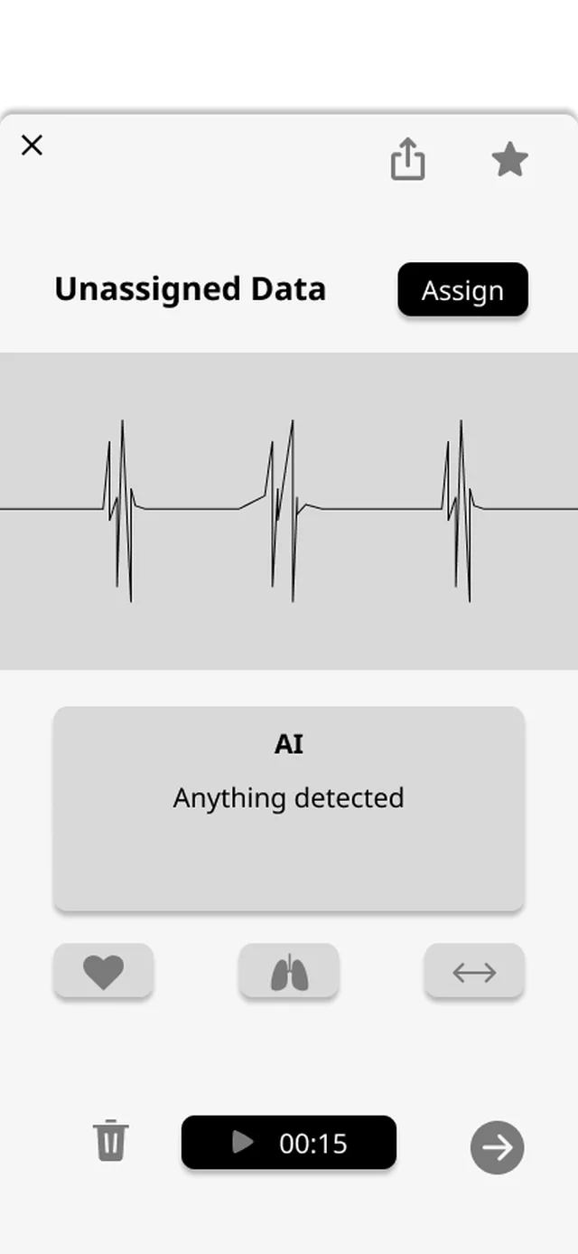 UI 1.0 result screen: a waveform and an AI box that says anything detected